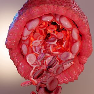 Tecar terapia controindicazioni