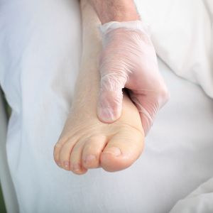 Edema alle gambe
