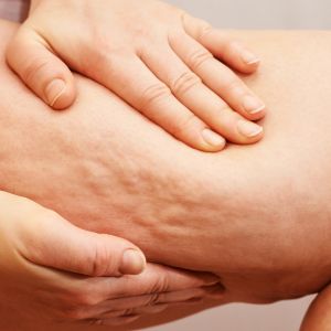 Pressoterapia e linfodrenaggio