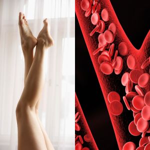 Perché spazzolare le gambe