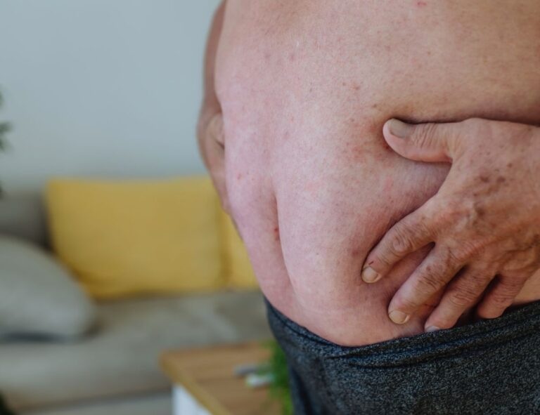cellulite pancia uomo
