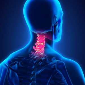 Curare la cervicale in modo definitivo