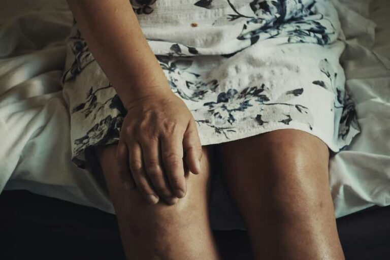 donna con gambe gonfie alla sera