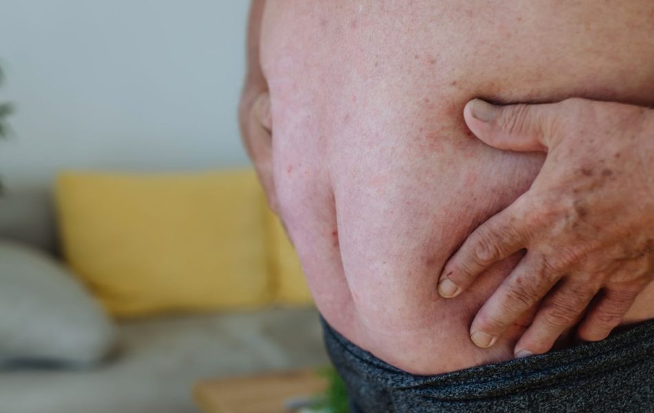 cellulite pancia uomo